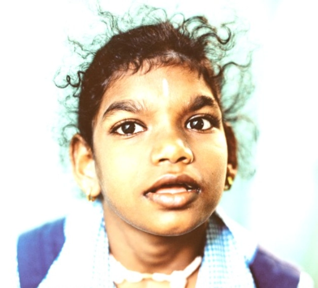 Hope Chennai special education activity